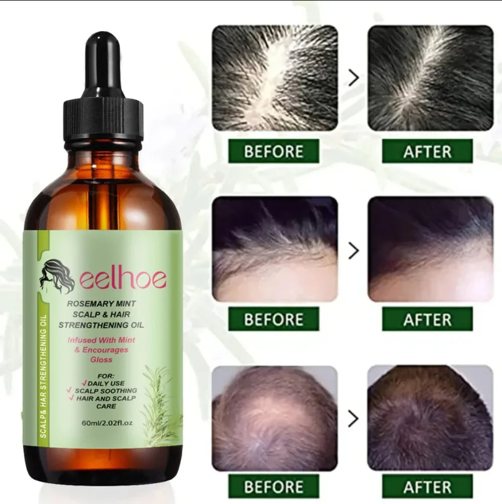 Hair Growth Essential Oil Rosemary Mint Hair Strengthening Oil Nourishing Treatment for Ends and Dry Organics Hair